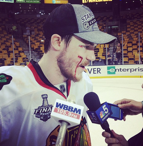 Andrew Shaw Talks With Reporters after Stanley Cup Victory  2013
