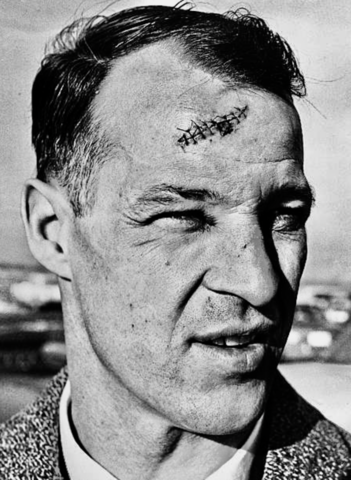 Mr. Hockey Gordie Howe received well over 300 stitches to his face during career