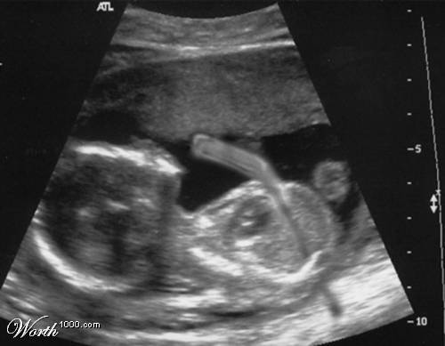 Hockey In The Womb
